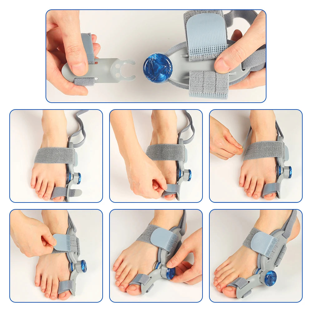 Bunion Corrector Orthopedic Toe Straightener