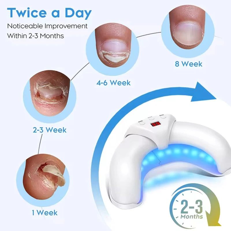 Fungal Nail Laser Device Repair Foot Care