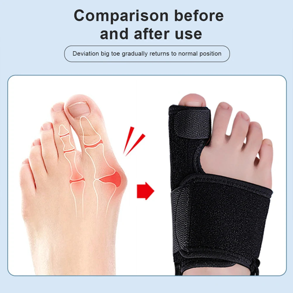 Toe Corrector Orthotics Bone Adjuster Hammer Protector