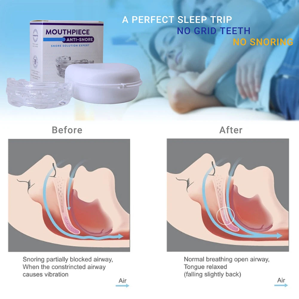 Anti-Snoring Mouth Guard Snoring Device