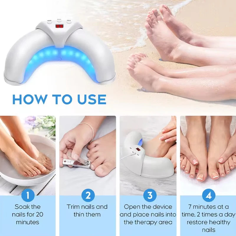 Fungal Nail Laser Device Repair Foot Care