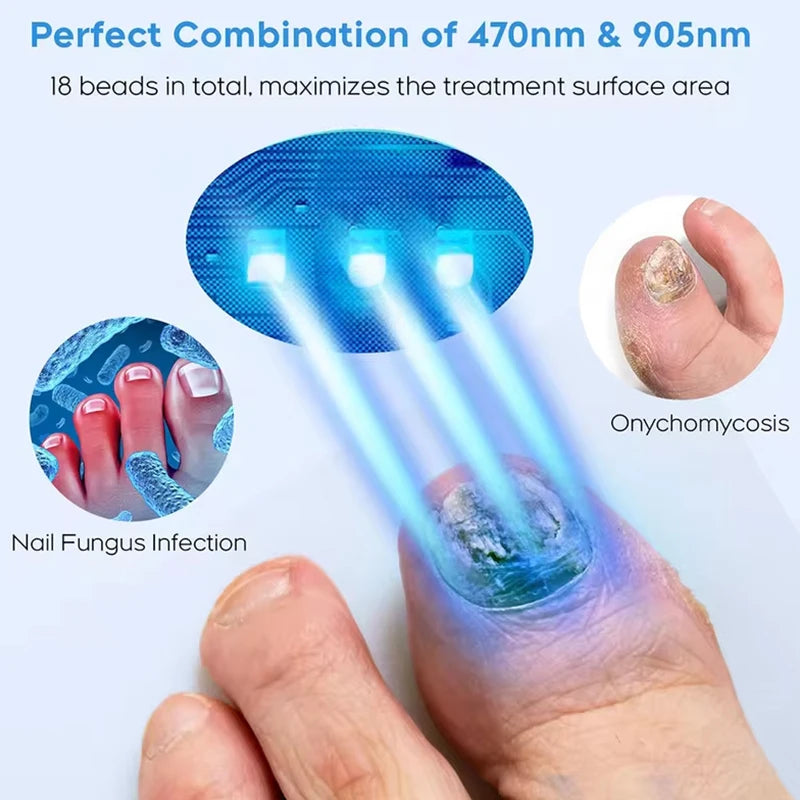 Fungal Nail Laser Device Repair Foot Care